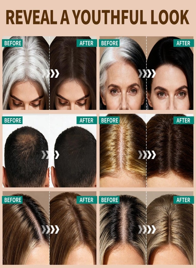 KIMUSE Hairline Powder, Root Touch Up Hair Color, Instantly Conceals Hair Loss, Bald Spot Thin Hair Powder with Dual-ended Hairline Brush for Women and Men, Transfer-proof & Sweat-proof - Image 5